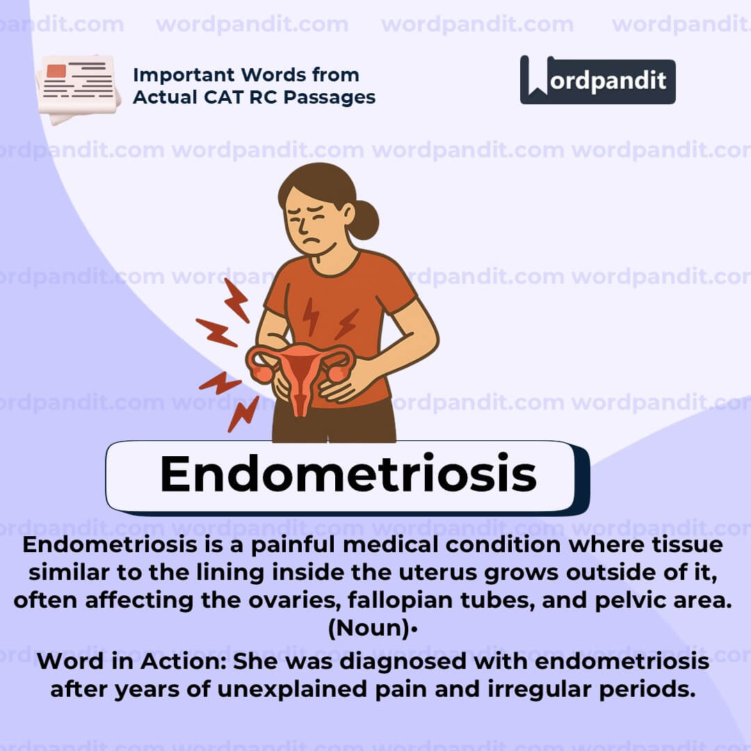 Endometriosis Endometriosis